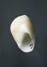 Polinices mammilla (Linnaeus, 1758)